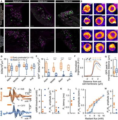 Developing Fast, Red-Light Optogenetic Stimulation of Spiral Ganglion Neurons for Future Optical Cochlear Implants